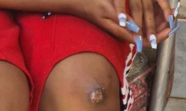 Other photos regarding to torturing Weasel done to Teta Sandra