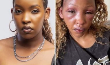 Violence against Sandra Teta keeps overwhelm Rwandans