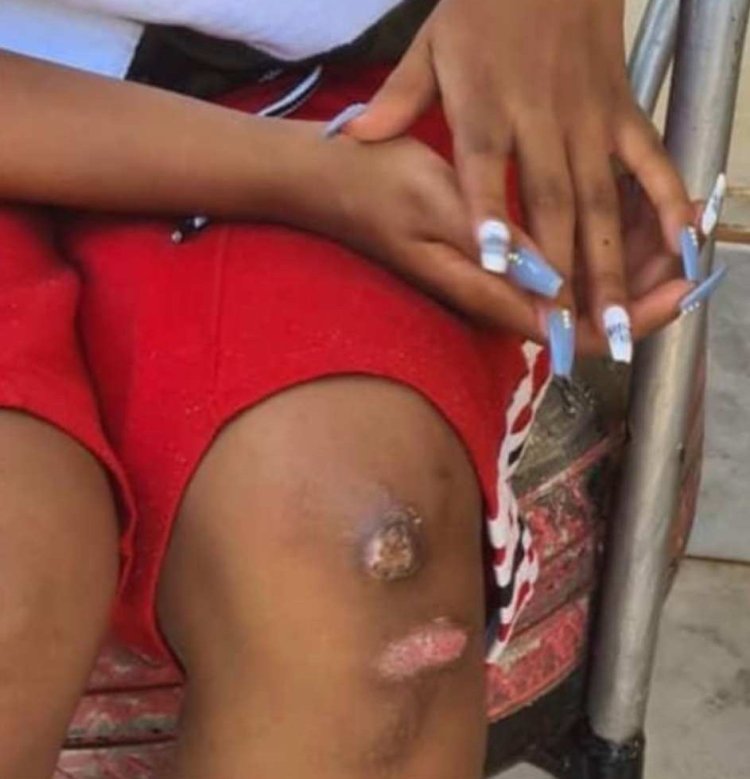 Other photos regarding to torturing Weasel done to Teta Sandra